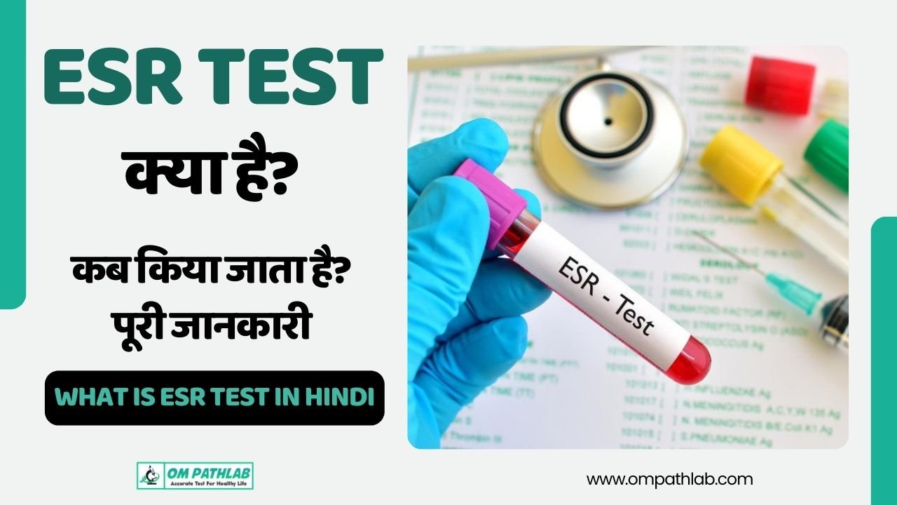 ESR test in hindi