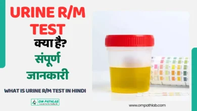 What is URINE RM Test in hindi