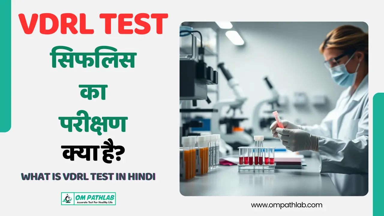 What is VDRL Test in hindi