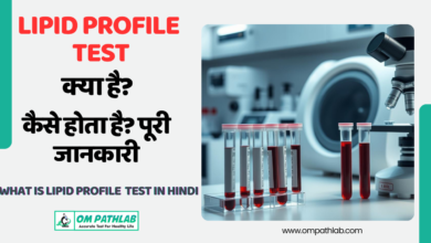 What is lipid profile TEST (1)