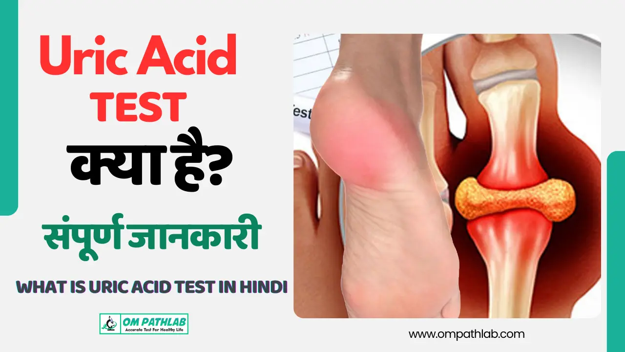 What is uric acid TEST Test in Hindi