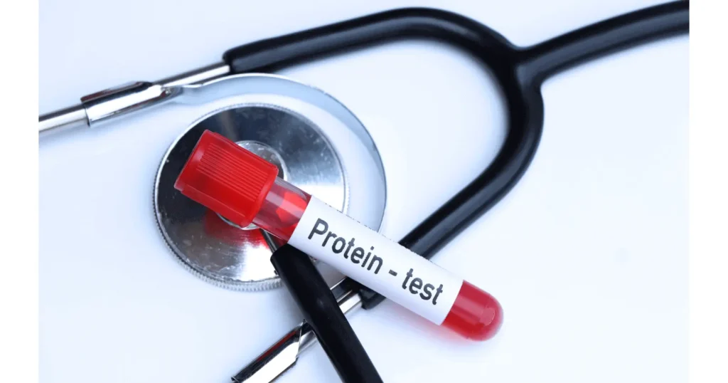 total-protein-test-in-hindi