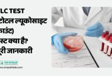 what is tlc test in hindi