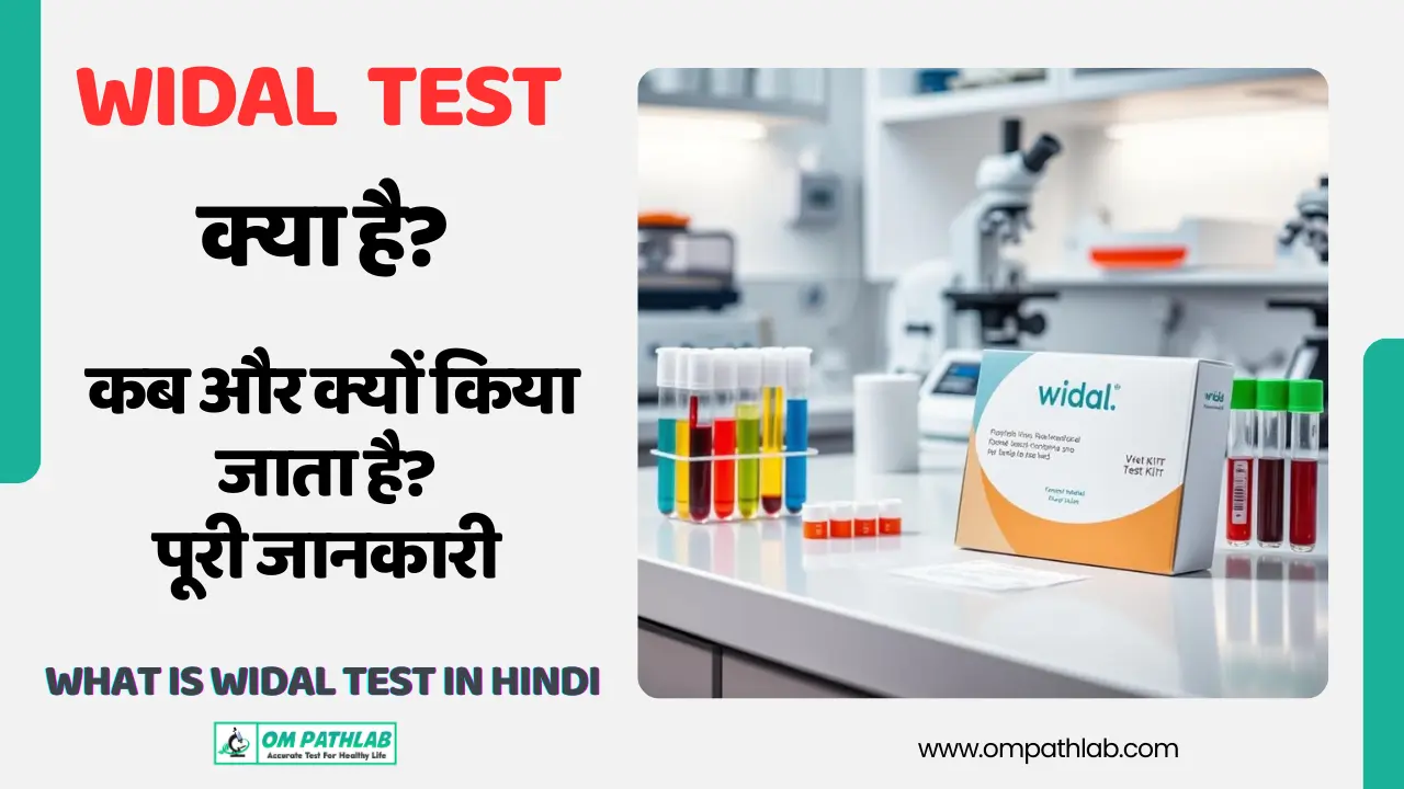 widal test in hindi