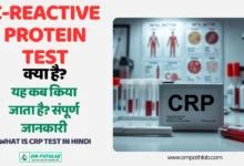 What is CRP Test in Hindi