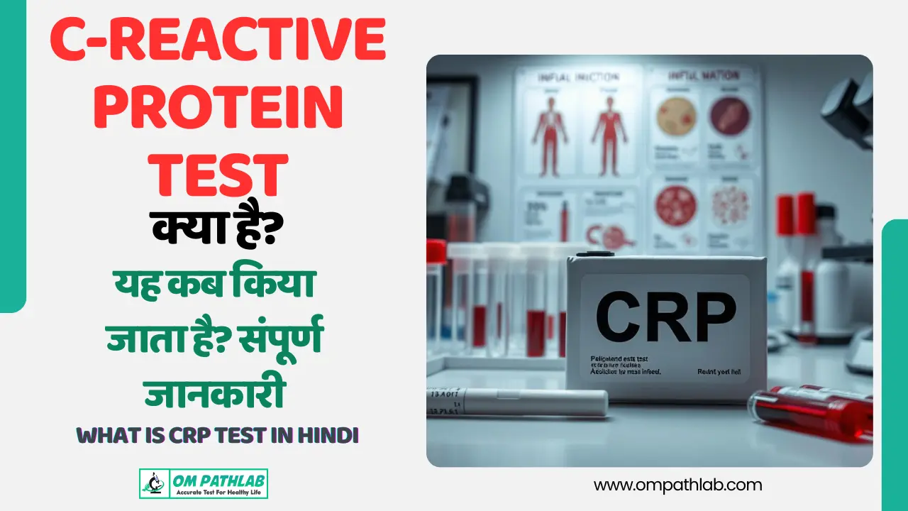 What is CRP Test in Hindi