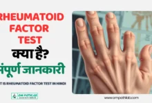 What is Rheumatoid Factor Test in Hindi