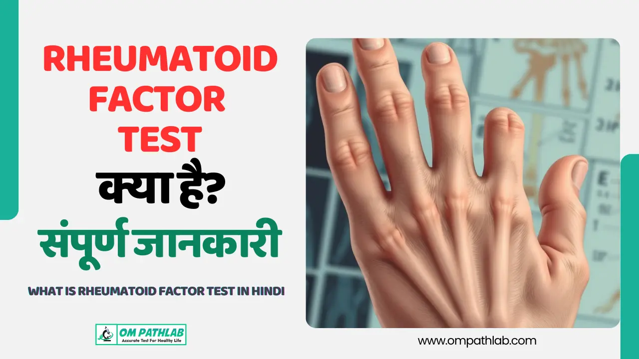 What is Rheumatoid Factor Test in Hindi