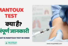 What is Mantoux Test in Hindi