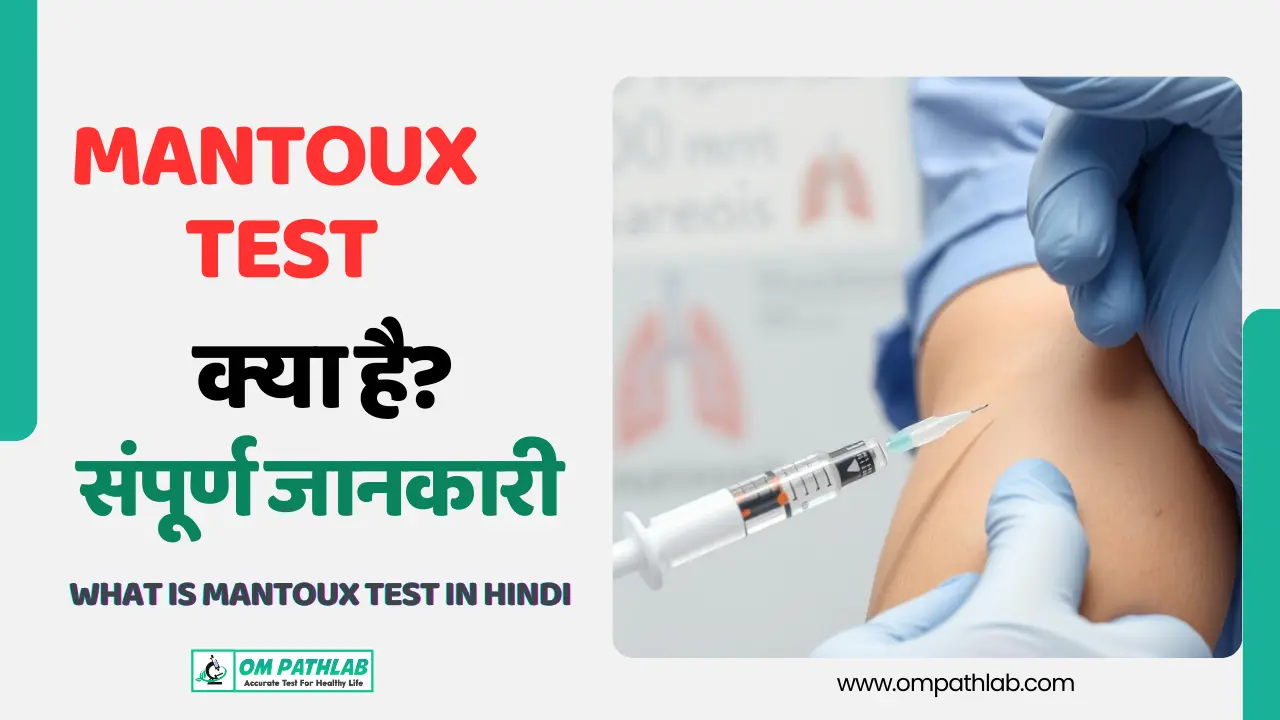 What is Mantoux Test in Hindi