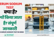 What is serum Sodium Test in Hindi