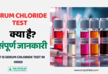 What is serum chloride Test in Hindi