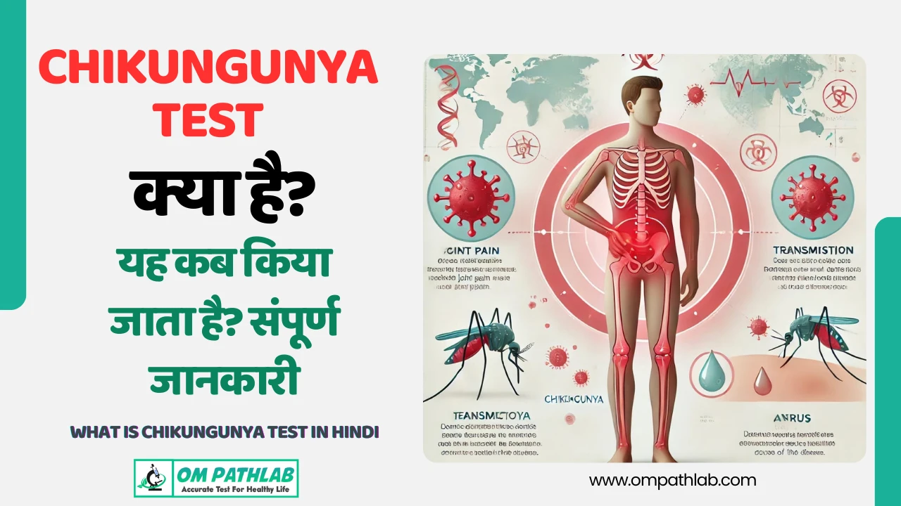 What is Chikungunya Test in Hindi